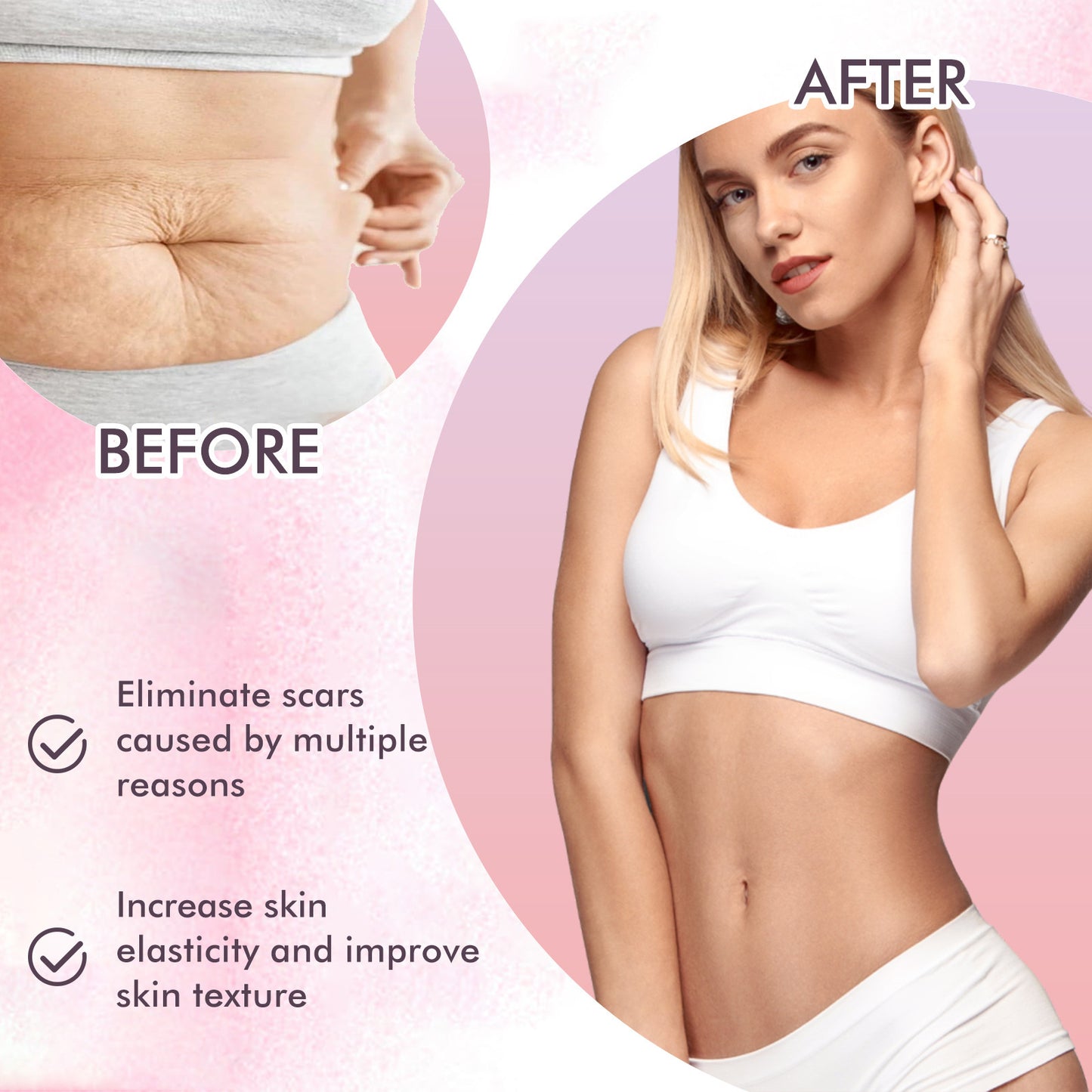 Skincare Body Oil, Fade Scars And Fine Lines Of Pregnancy Moisturize And Repair Delicate And Smooth Body Skin