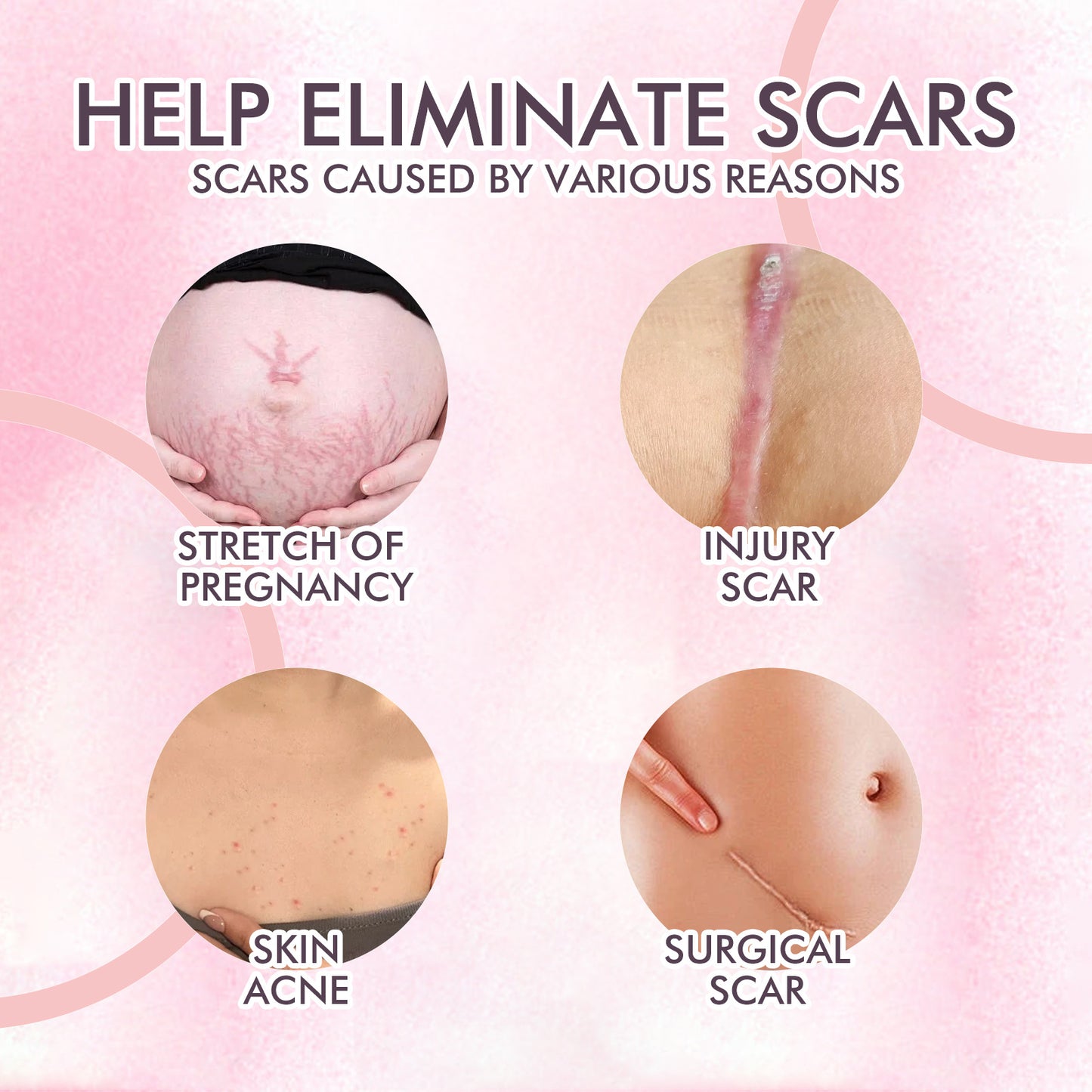 Skincare Body Oil, Fade Scars And Fine Lines Of Pregnancy Moisturize And Repair Delicate And Smooth Body Skin